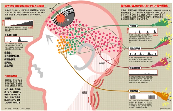集英社 健康百科「頭痛」